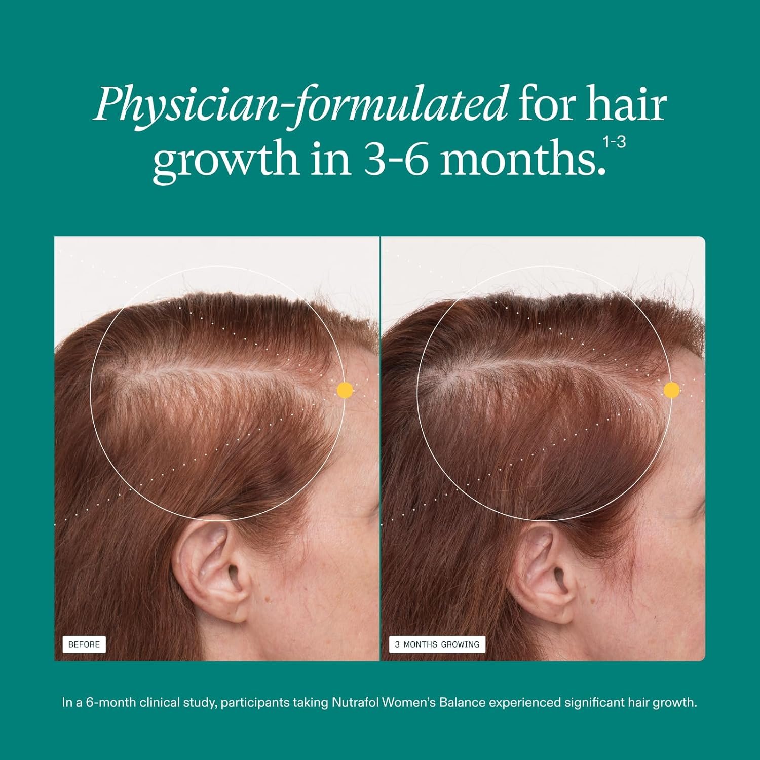 Nutrafol Women's Balance Hair Growth Supplements for Hair Thinning Ages 45 and Up Clinically Tested for Visibly Thicker Hair and Scalp Coverage Dermatologist Recommended 1 Month Supply